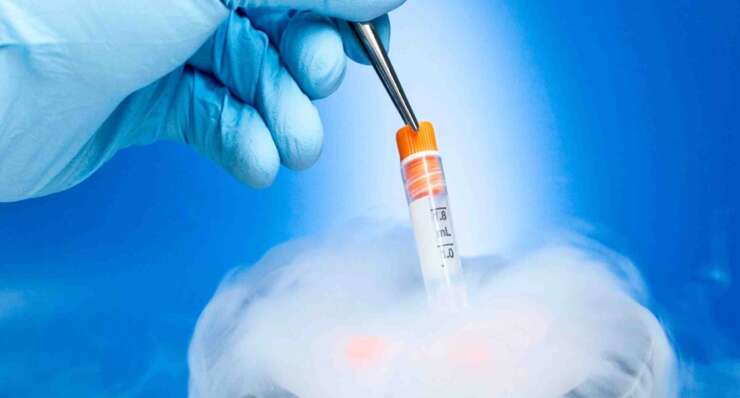 Egg Freezing / Fertility Preservation